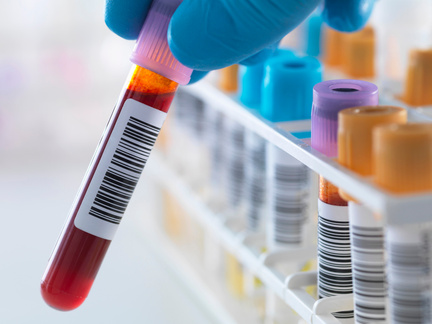 "A blood sample being held with a row of human samples for analytical testing including blood